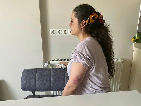 1591535258593.jpg İstanbul'da kan donduran olay! Boşanmak isteyen eşine dehşeti yaşattı-2