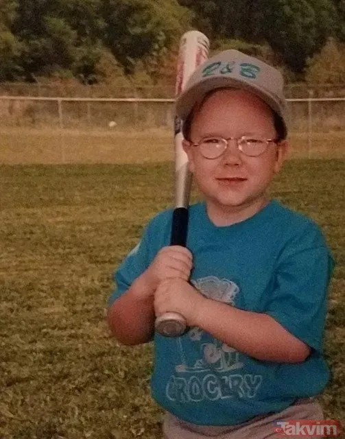 Bu Kişi 7 Yaşında Gibi Görünse De Aslında 37 Yaşında.