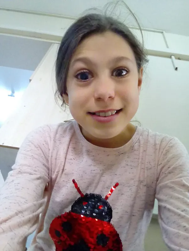 İzmir'de korkunç olay! Gözünü bıçakladı - 4