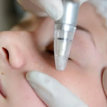 Güzelliğin bedeli ağır olmasın! Uzmanlar açıkladı: Meğer herkesin yaptırdığı o uygulama...