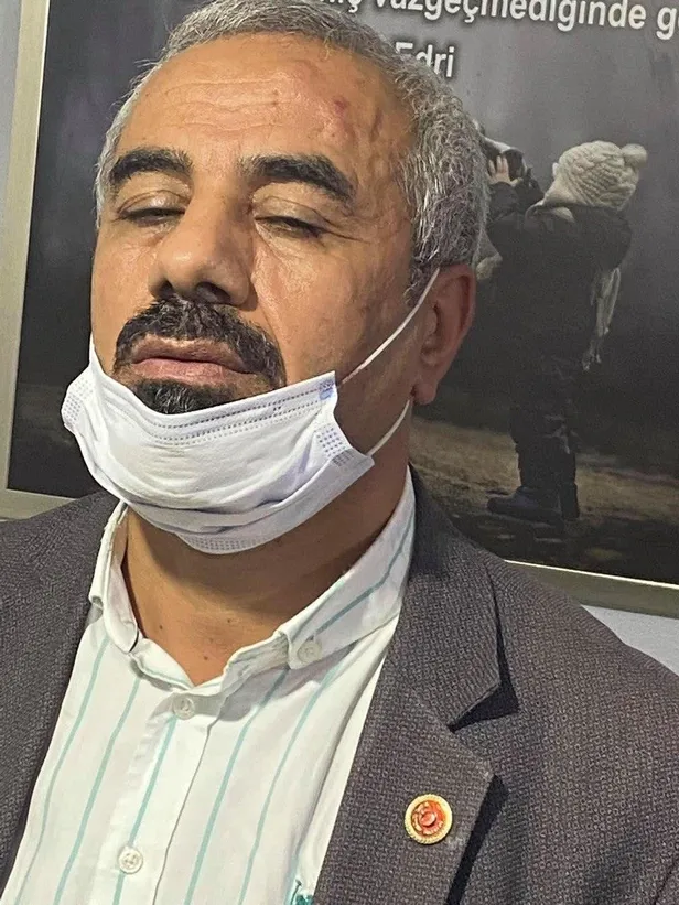 talimat-chp-istanbul-il-baskan-yardimcisi-kemal-arsevenden-chpli-hakan-poyraz-chpli-halit-kolliki-hastanelik-etti-1633281914822.jpeg Talimat CHP İstanbul İl Başkan Yardımcısı Kemal Avseren'den! CHP'li Hakan Poyraz CHP'li Halit Kollik'i hastanelik etti-4