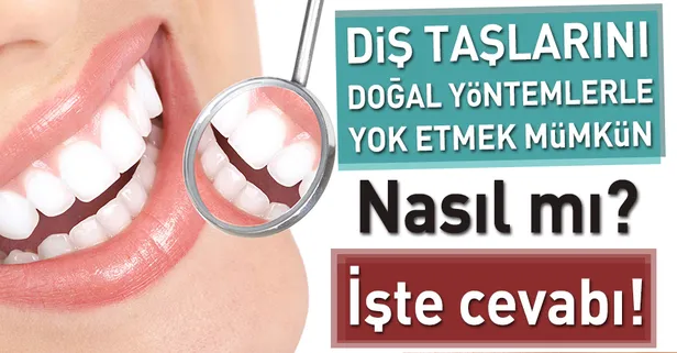 Diş taşlarınızı doğal yöntemlerle yok etmenin yolları