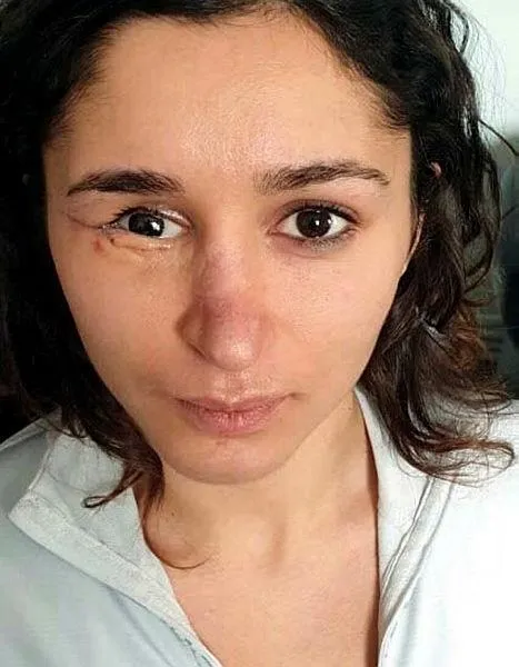 İzmir'de Tuğçe Aras ayrılmak isteyince önce gözünü kaybetti ardından koku alma duygusunu-2