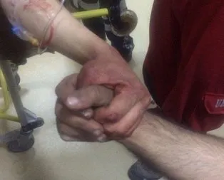Afrin’de yaralanan askerlerin yüreklere dokunan fotoğrafı
