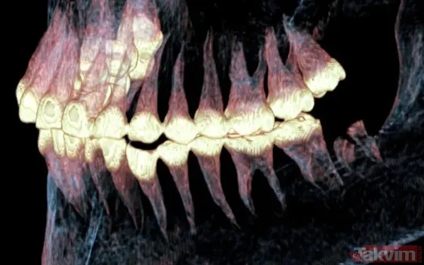 Antik çağın cerrahları: 2.500 yıllık mumyada at kılından yapılan protez keşfedildi - 3