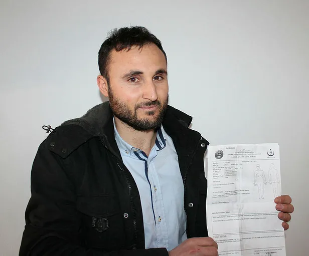 Aksaray'da genç bir adam ekmeği yerken içindeki vidayı yuttu-1