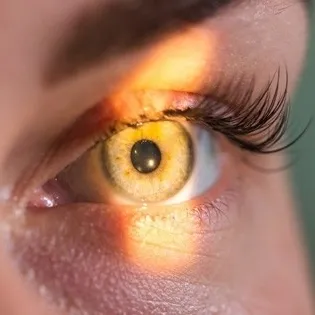 Gözümüzdeki sarı alarm