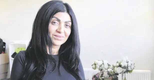 Yaptırdığı estetikten sonra yüzünde felç oluşan Selbi Liman hukuk mücadelesi başlattı!