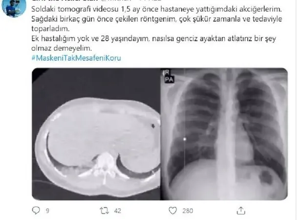 Koronavirüse yakalanan genç doktor 10 günde 8 kilo verdi! Tomografi görüntüsüyle uyardı!-1