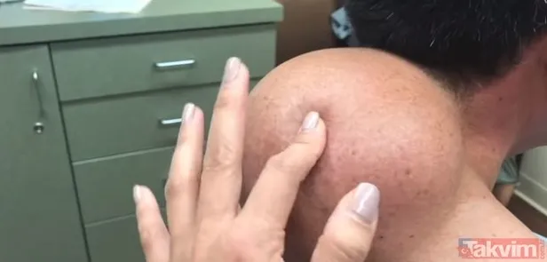 agri-sikayeti-ile-gittigi-hastanede-karnindan-9-kilo-800-gram-kitle-cikarildi-1607412936812.jpg Ağrı şikayeti ile hastaneye gitti! 18 yaşındaki kızın karnından 9 kilo 800 gram kitle çıkarıldı-6