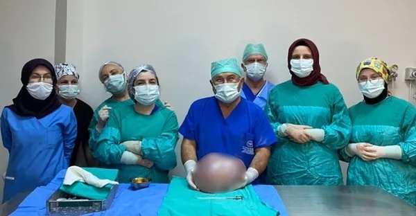 amasyada-hamile-oldugunu-dusunen-kadinin-karnindan-65-kilogram-kitle-cikti-1623910474248.jpg Amasya'da hamile olduğunu düşünen kadının karnından 6,5 kilogram kitle çıktı-2