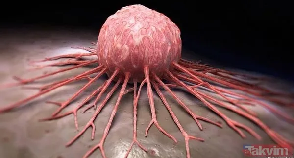 Ağız kokusu kanserin habercisi - 13