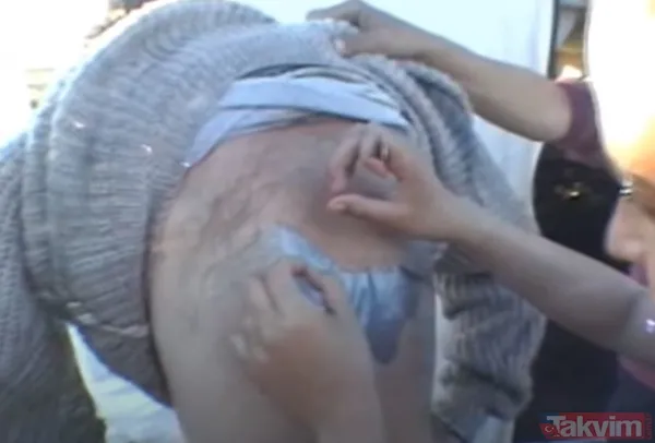 Karnındaki şişlik için gitti içinden çıkan doktorları bile şoke etti! Yer uzak değil Kayseri! 64 kilo girdi 55 kilo çıktı - 12