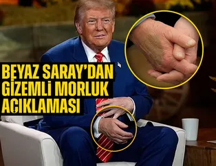 Trump’ın elinde gizemli morluk! Söylentiler arttı: Beyaz Saray’dan ilginç açıklama