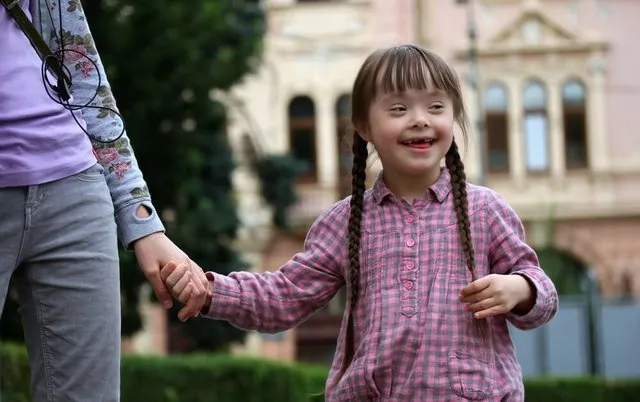 down sendromu nedir neden olur