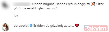 Hande Erçel’in estetiksiz halini gören Ebru Polat bakın ne tepki verdi! Değişimiyle konuşulan Hande yine sosyal medyanın gündeminde - 7