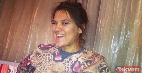 'Hehe' diyerek paylaştı son pozunu gören gözlerine inanamadı! Yıldız Tilbe'nin dişine ne oldu? 57 yaşındaki Yıldız Tilbe... - 23