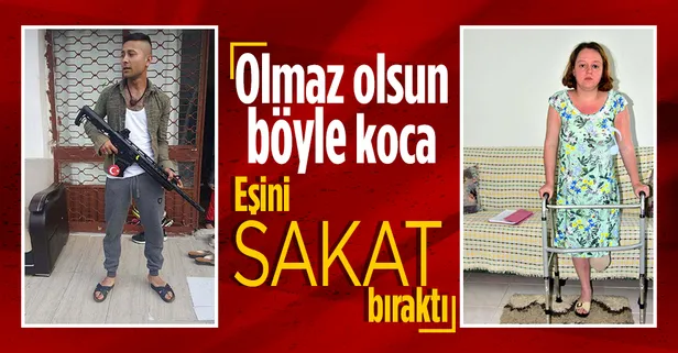 Eşini pompalı tüfekle vurdu bacağının kesilmesine neden oldu! 20 yıl hapsi isteniyor