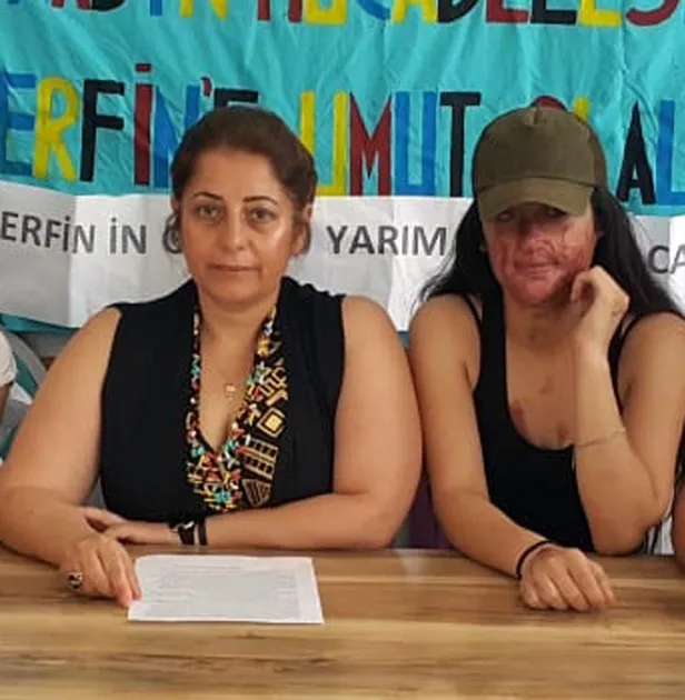 Berfin'in yüzüne asit türü sıvı atan sanık hakim karşısında-4