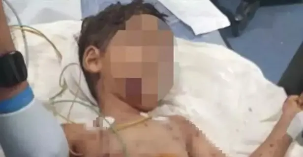 Adana’da 5 yaşındaki çocuk başıboş köpeklerin saldırısına uğradı! Durumu ağır