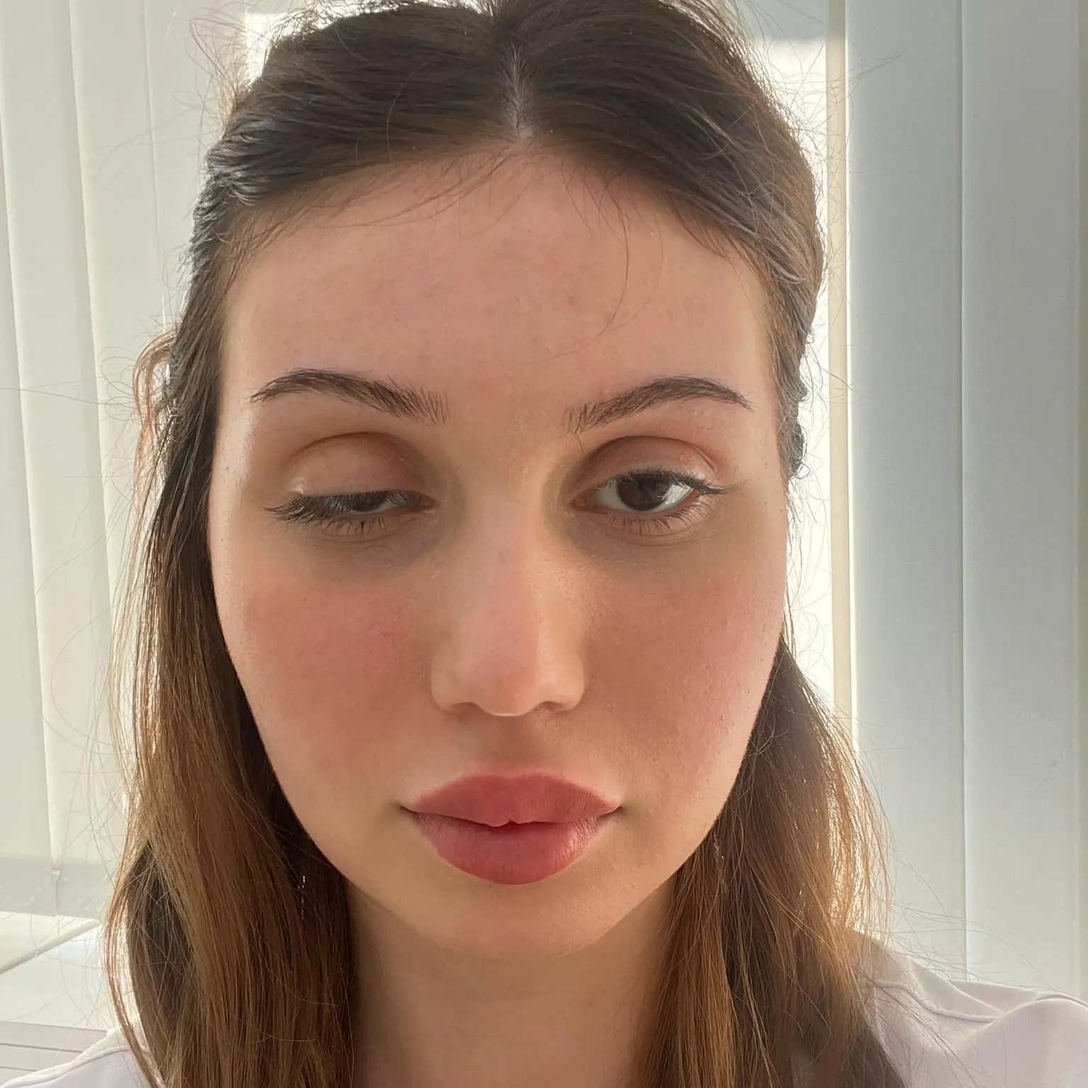 Botoks faciası