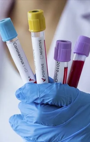 Koronavirüsten iyileşenlerin sayısı 330 bini aştı