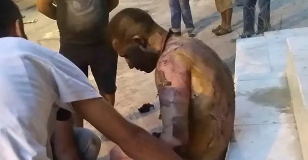 İzmir'de 2 hafta önce tinerle yakılan madde bağımlısı öldü