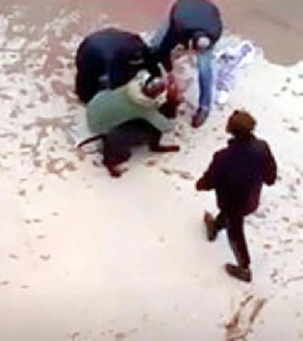 Gaziantep'te Pitbull dehşeti! 4 yaşındaki Asiye Ateş ağır yaralandı... 3 tutuklama-3