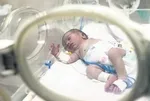 İsrail’den hava bombası! Gazzeli bebekler nefes alamıyor: 34 oksijen istasyonundan 22’si hizmet dışı