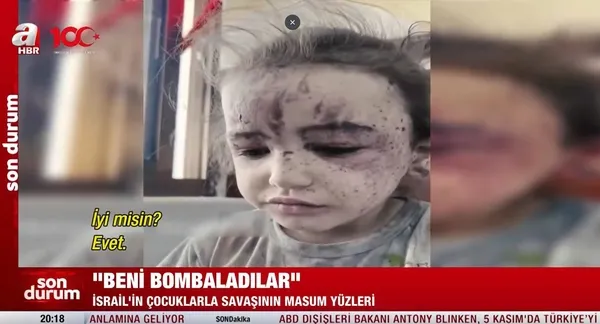 katil-israilin-bombaladigi-kucuk-rital-yurekleri-burktu-beni-bombaladilar-1699040467206.jpeg Katil İsrail'in bombaladığı küçük Rital yürekleri dağladı: Beni bombaladılar-4