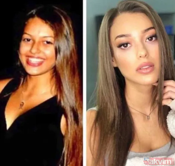 Esra Bilgiç de çok değişmiş çok! Pabucunu bu kez başkası değil kendisi dama attı... Güzel oyuncu Esra Bilgiç meğer... - 25