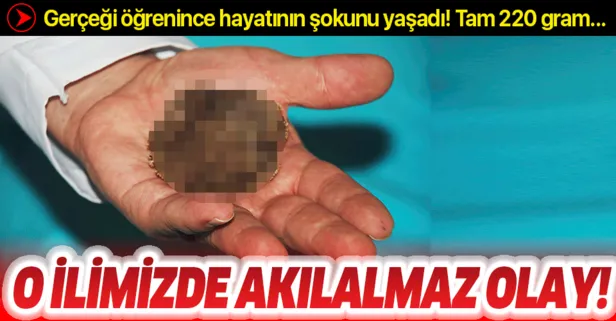 Mesanesinde 220 gramlık tek parça taş çıktı