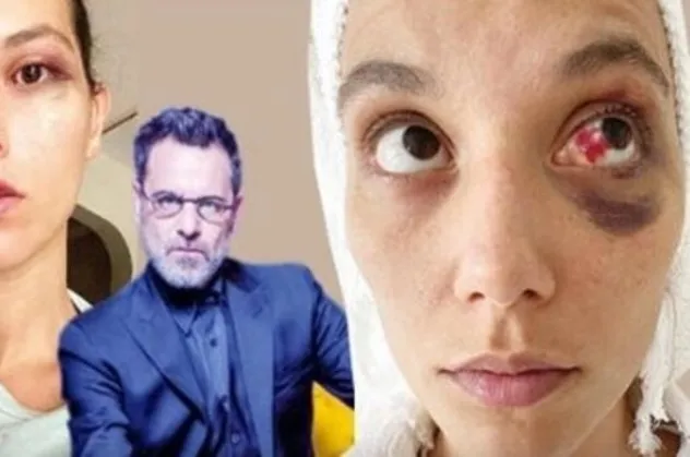 Ozan Güven'in genç sevgilisi Deniz Bulutsuz'u darp ettiği olayda gelişme | Tek tek incelenecek