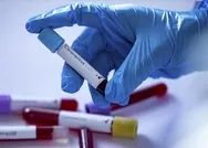 Son dakika: Dünyada koronavirüsten iyileşenlerin sayısı 560 bini aştı