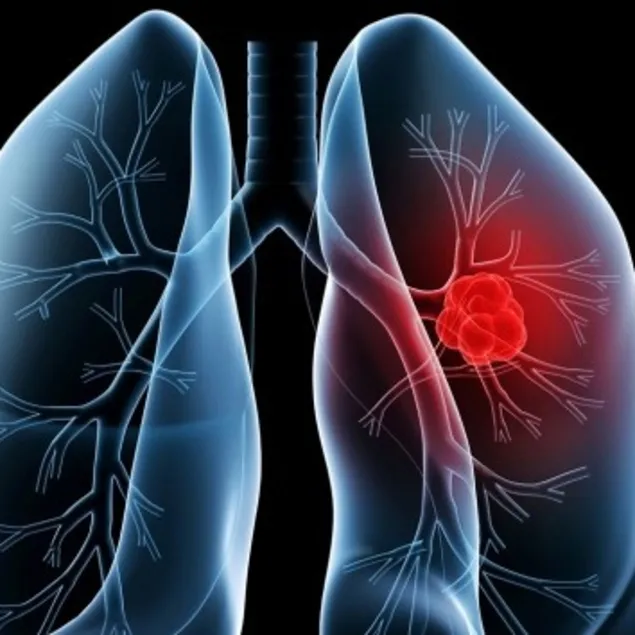 Akciğer tansiyonu deyip geçmeyin!