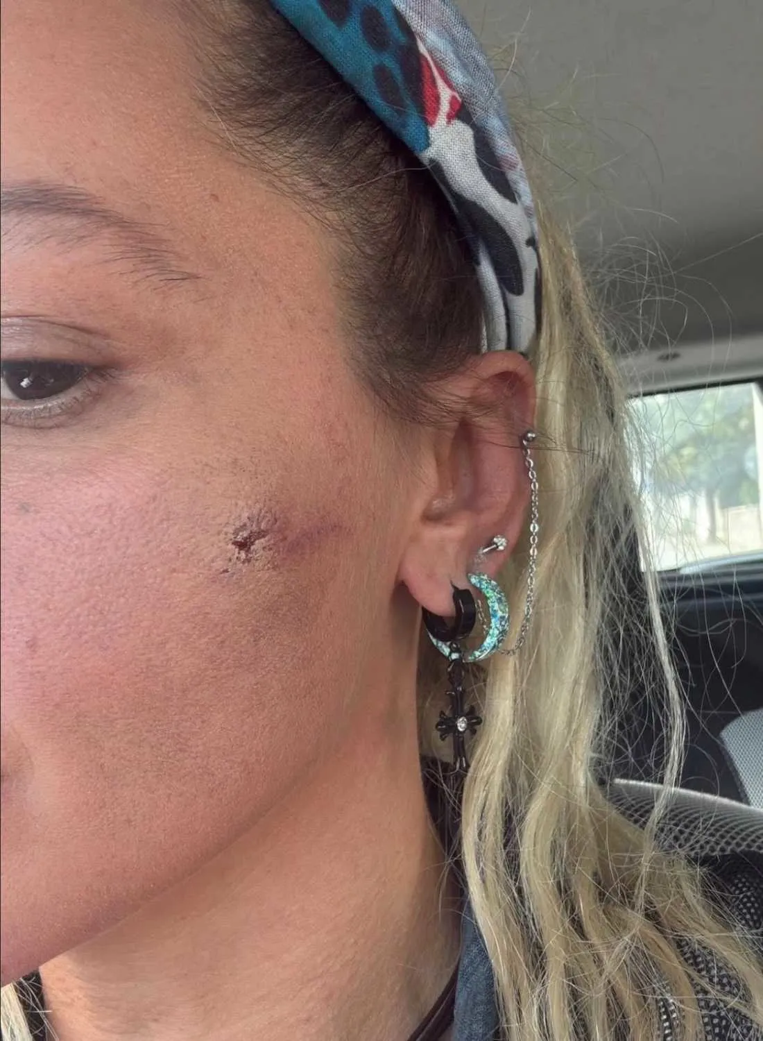 yildiz-asyali-son-durumu-ne-siddet-olayinda-yeni-paylasim-can-guvenligimiz-yok-1776755744367.jpeg Yıldız Asyalı son durumu ne? Şiddet olayında yeni paylaşım: "Can güvenliğimiz yok"-4