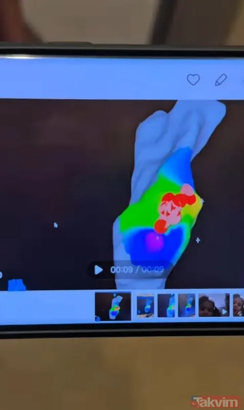 Elvin Levinler’den kalp ameliyatı itirafı - 3