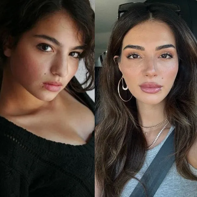 Yasemin Özilhan estetik açıklamasıyla sosyal medyanın diline düştü: Yeme bizi Yasemin! - 12