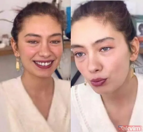 Neslihan Atagül korkutan hastalığı yüzünden İngiltere'de! Sefirin Kızı dizisine ivedilikle veda etmişti... - 9