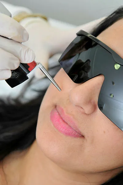 diyanete-gore-orucluyken-lazer-epilasyon-yaptirmak-orucu-bozar-mi-agda-yapmak-kas-biyik-aldirmak-oruca-engel-o-1648555412510.jpg Ağda yapmak, kaş bıyık aldırmak oruca engel olur mu? Diyanet'e göre oruçluyken lazer epilasyon yaptırmak orucu bozar mı?-7