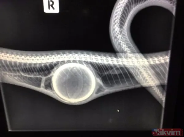 Midesine güvenenler baksın! Kulak ağrısıyla hastaneye giden adamın kulağından çıkanlar dünyayı şoke etti - 32