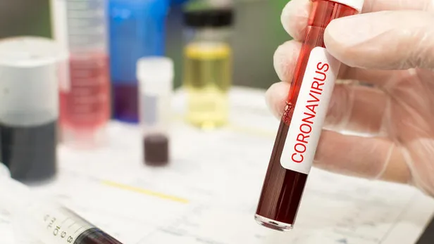 Son dakika: Dünyayı umutlandıran gelişme! Koronavirüs aşısı için tarih verildi!-5