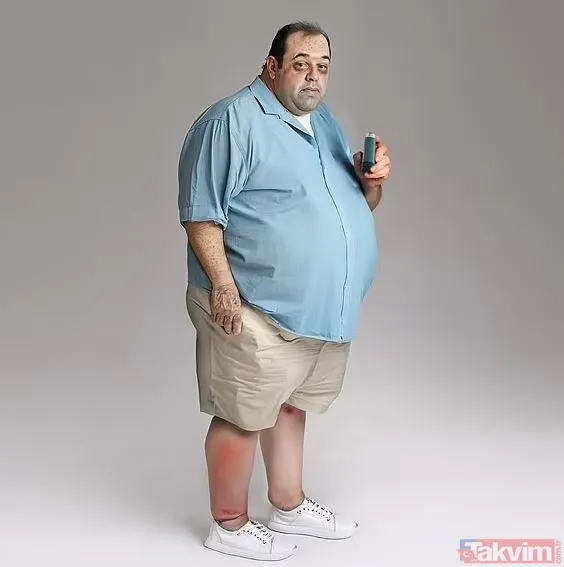 30 Ytıl Sonra Böyle Gözükecekler Yapay Zeka Tarafından Oluşturulan "Michael" Modeli, Kötü Beslenmenin Bir Sonucu Olarak Ciddi Sağlık Sorunlarıyla Mücadele Eden...