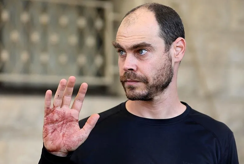 Eygi’yi göz göre göre katlettiler!