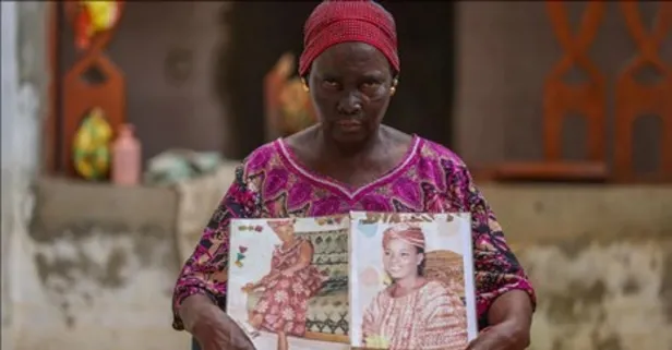 Afrika’da milyonlarca kadın cilt beyazlatma ürünleri nedeniyle sağlık riskiyle karşı karşıya