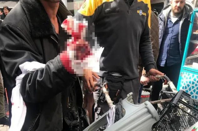 Döner ustası tartıştığı müşteriyi elinden bıçakladı