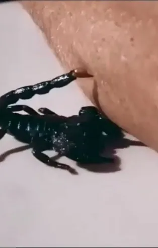 Aydın’da akrep alarmı! 9 yaşındaki kızı soktu