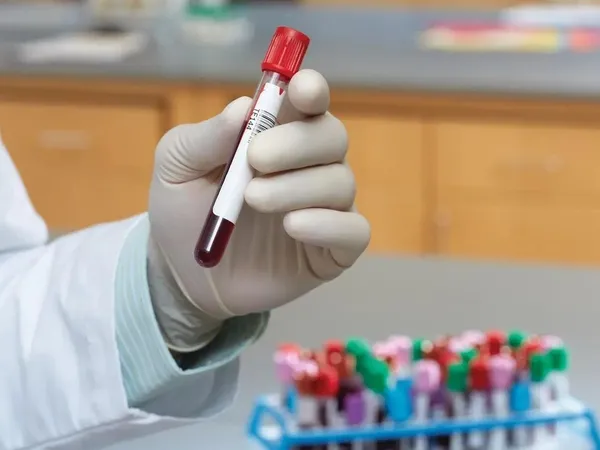 1649053530249.jpeg AIDS’e yol açan HIV virüsü şoku! Genç kadın bunalıma girdi! Doktora tazminat davası-2