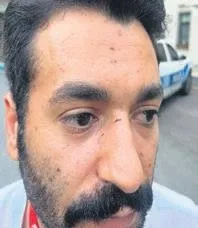 eski-besiktasli-manuel-fernandes-kirmizi-kartlik-eglence-bes-guzelle-yakalaninca-bakin-ne-yapti-1659300871193.jpeg Eski Beşiktaşlı Manuel Fernandes kırmızı kartlık eğlence! Beş güzelle yakalanınca bakın ne yaptı-3