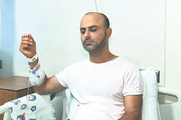 Yanağındaki kılları aldırmak için epilasyona gitti hayatı karardı!
